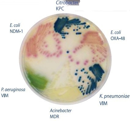 Hylabs̼��ùϩ���ˎ�c�U����CRE���z�y��֬���B(y��ng)��